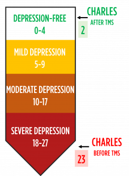 A PHQ-9 test result of a TMS patient indicating they are free from depression