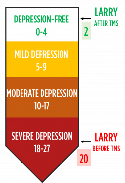 Beginning and ending PHQ-9 scores for a patient who completed TMS therapy