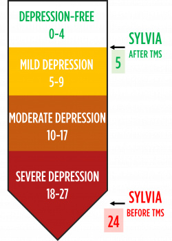 Scale showing PHQ-9 improvement for Sylvia, who treated her depression with TMS